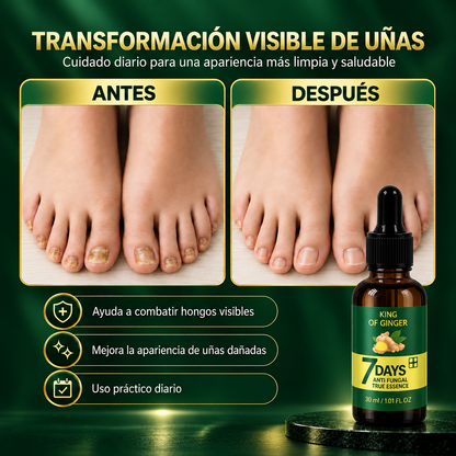 Recupera la Apariencia de tus Uñas | 2x1 HOY